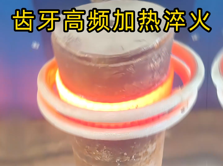 齿轮齿面高频91视频黄色下载大全淬火：现代机械传动的关键表面强化工